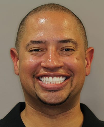 image patient smiling